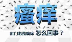 肛門(mén)瘙癢治不好嗎？先檢查病因就好辦！